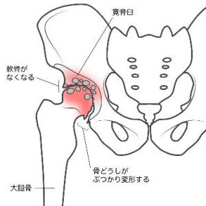 股関節